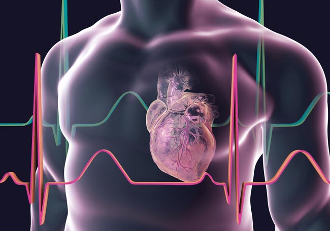 sindrome de brugada tractament experimental comprar dea